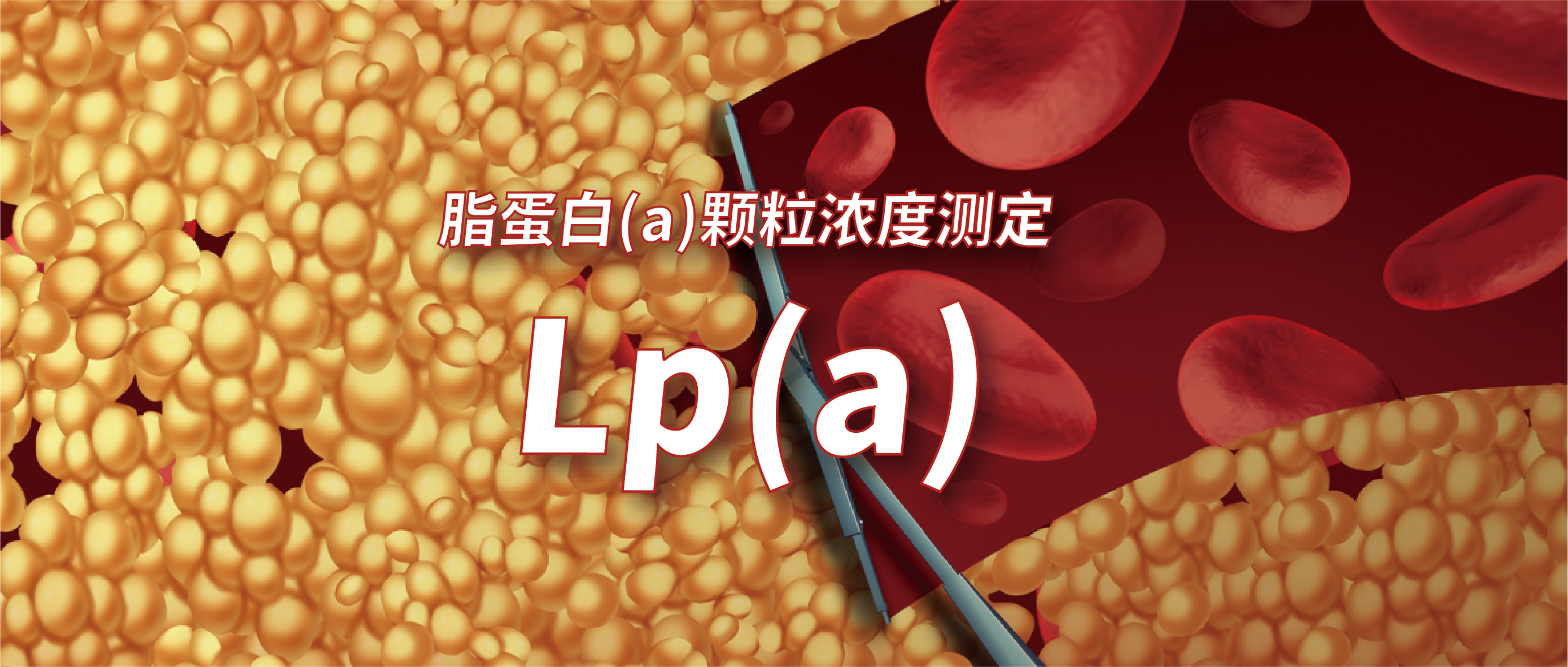 Lp(a)测定如何选择？质量浓度法or颗粒浓度法？